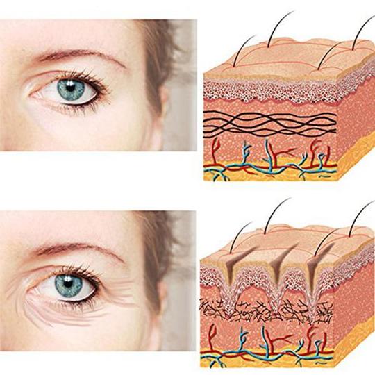 Reusable Silicone Anti-Wrinkle Eye Patches and Masks