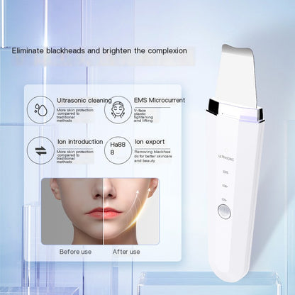 Ultrasonic Microcurrent Skin Cleansing Device