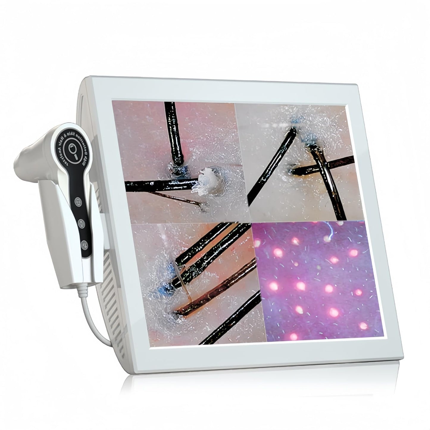 Professional 15-Inch Scalp Camera for Beauty Salons – High-Resolution Hair and Scalp Analysis Device with Image Storage Easy Assembly Durable Build Ideal for Client Consultations & Head Spa
