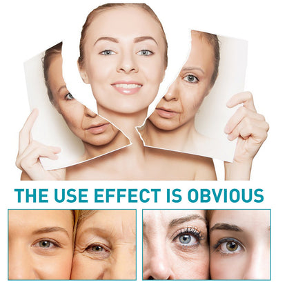 EELHOE Hydroconus Peptide Anti-Wrinkle Serum, Skin Repair Crow's Feet Law Firming Wrinkles And Beautifying Skin